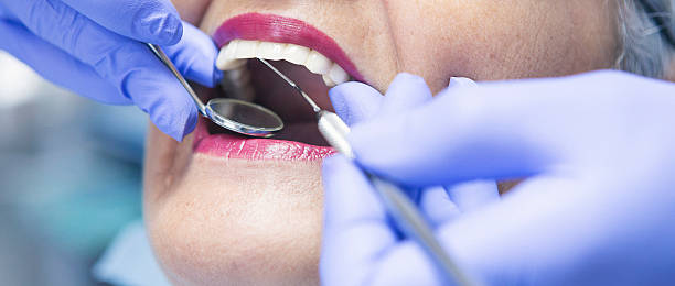 Best Emergency Broken Tooth Repair in Oelwein, IA